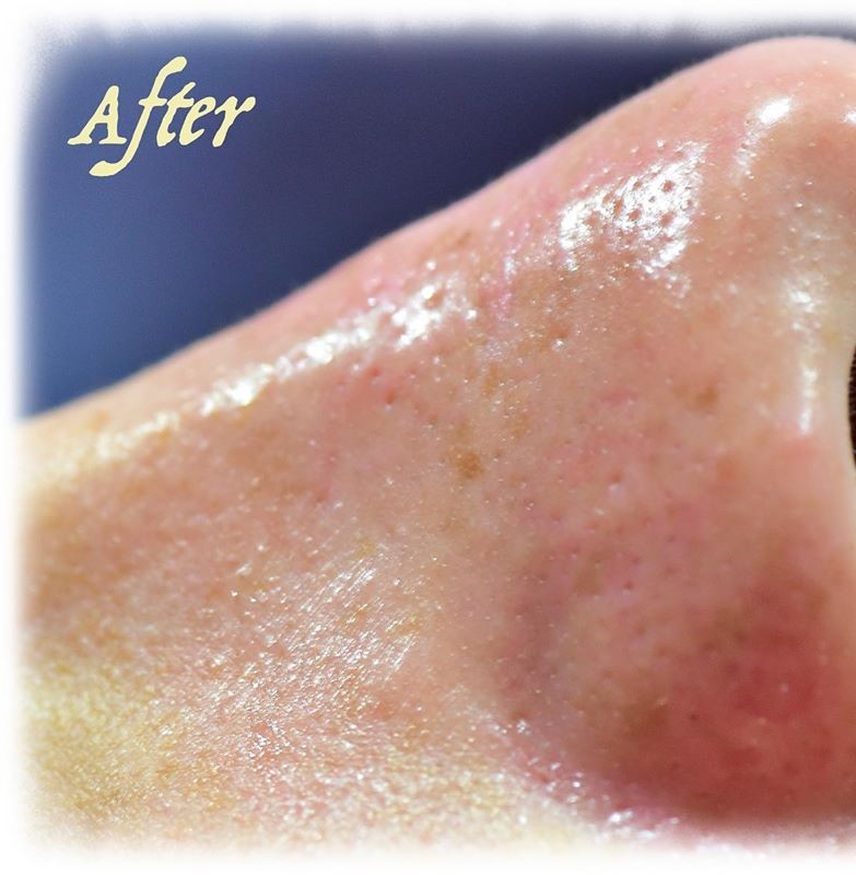 Introducing our new Extraction Facial treatment!! Okinawa Nail Salon · Spa Cocok*ココ